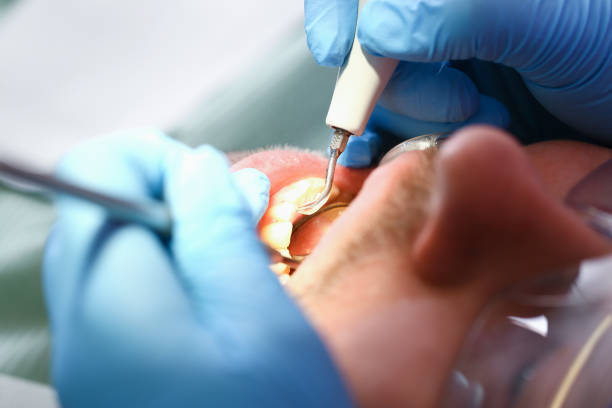 Best Emergency Dental Care for Broken or Chipped Teeth in University Park, IL