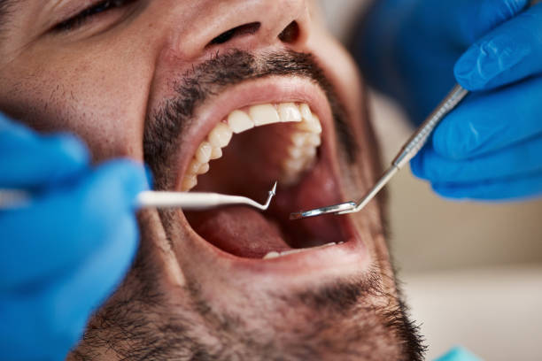 Best Urgent Care for Lost Fillings or Crowns in University Park, IL