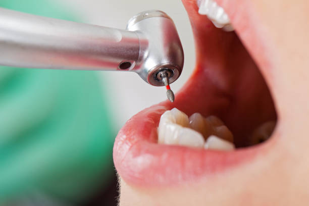 Best Pediatric Emergency Dentist in University Park, IL